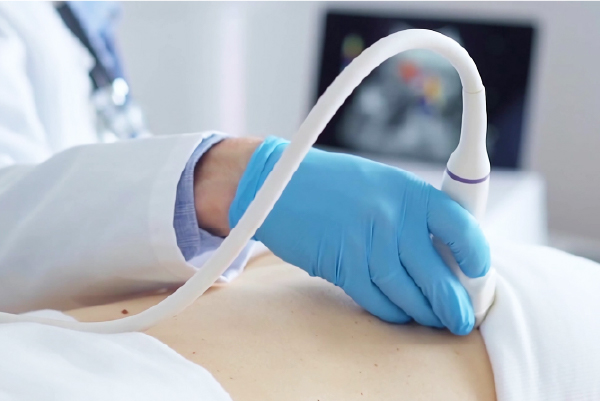 AIを用いた画像診断のダブルチェックで確かな診断を