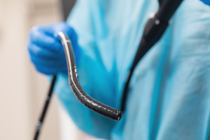 大腸カメラ検査