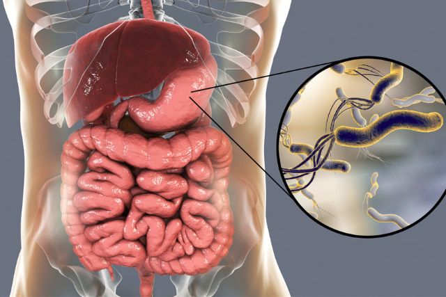 ピロリ菌検査・除菌
